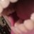 chacal